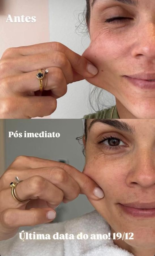 Foto de trabalho de LEONORA FABRI ESTÉTICA FACIAL E CORPORAL