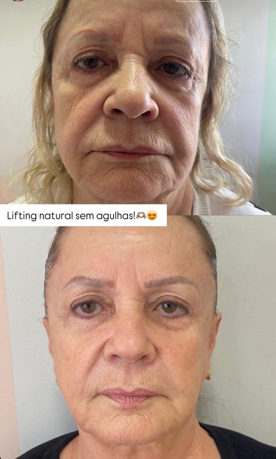 Foto de trabalho de LEONORA FABRI ESTÉTICA FACIAL E CORPORAL