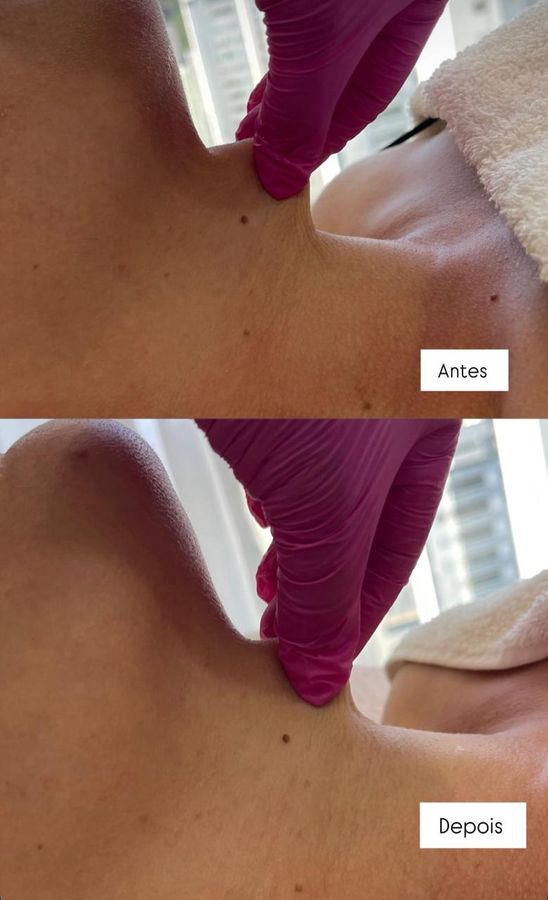 Foto de trabalho de LEONORA FABRI ESTÉTICA FACIAL E CORPORAL