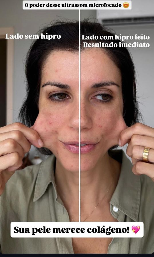 Foto de trabalho de LEONORA FABRI ESTÉTICA FACIAL E CORPORAL