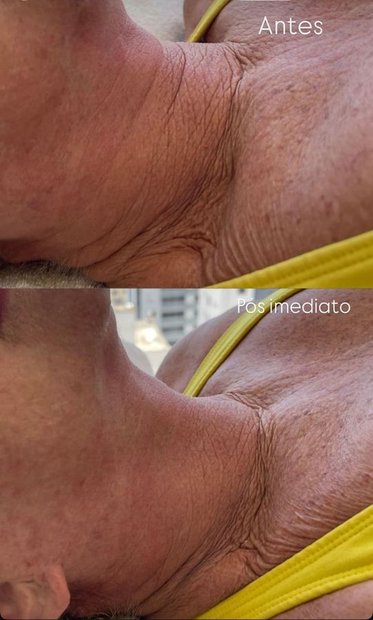 Foto de trabalho de LEONORA FABRI ESTÉTICA FACIAL E CORPORAL